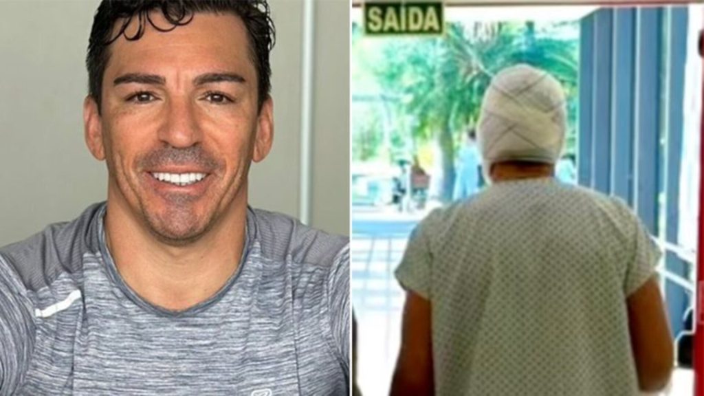 Antigo jogador da Seleção nacional hospitalizado após acidente grave com queimaduras