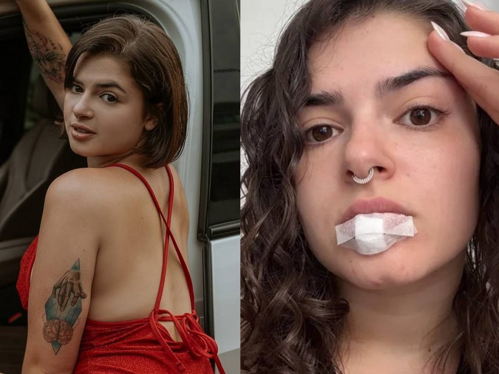 Miss Bumbum revela acidente inusitado durante o sexo: “Cheio de sangue”