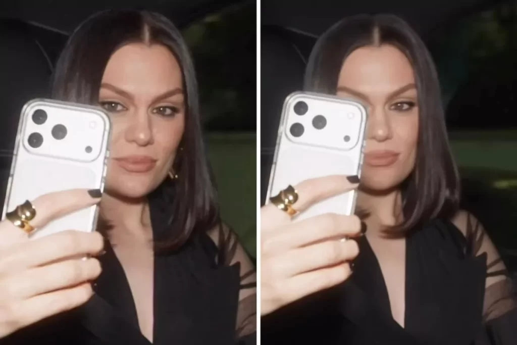 O drama e a força de Jessie J após diagnóstico de câncer – OFuxico