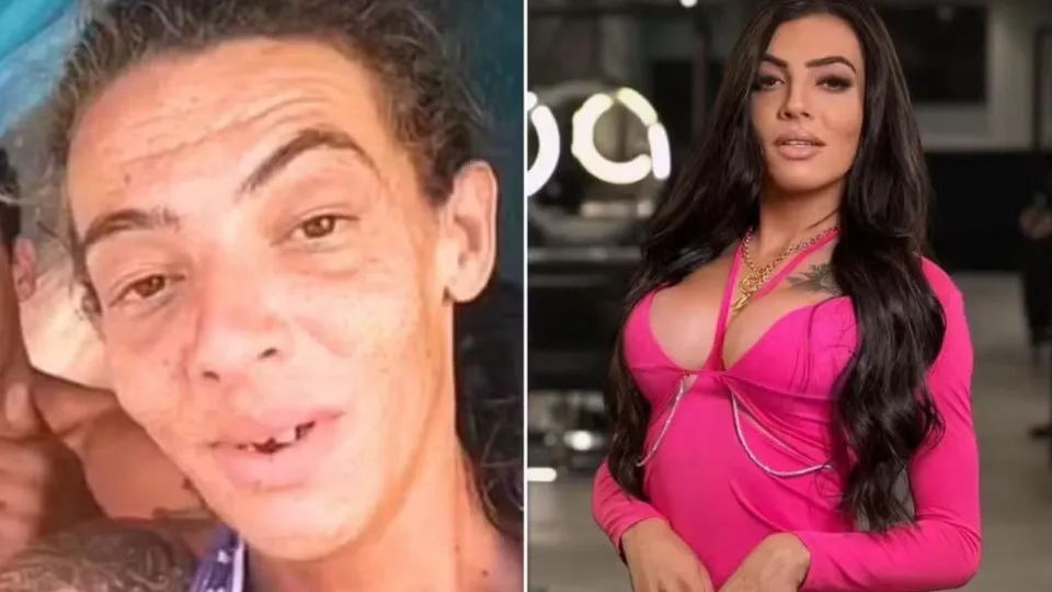 Influenciadora que já viveu nas ruas realiza 10ª cirurgia e surpreende