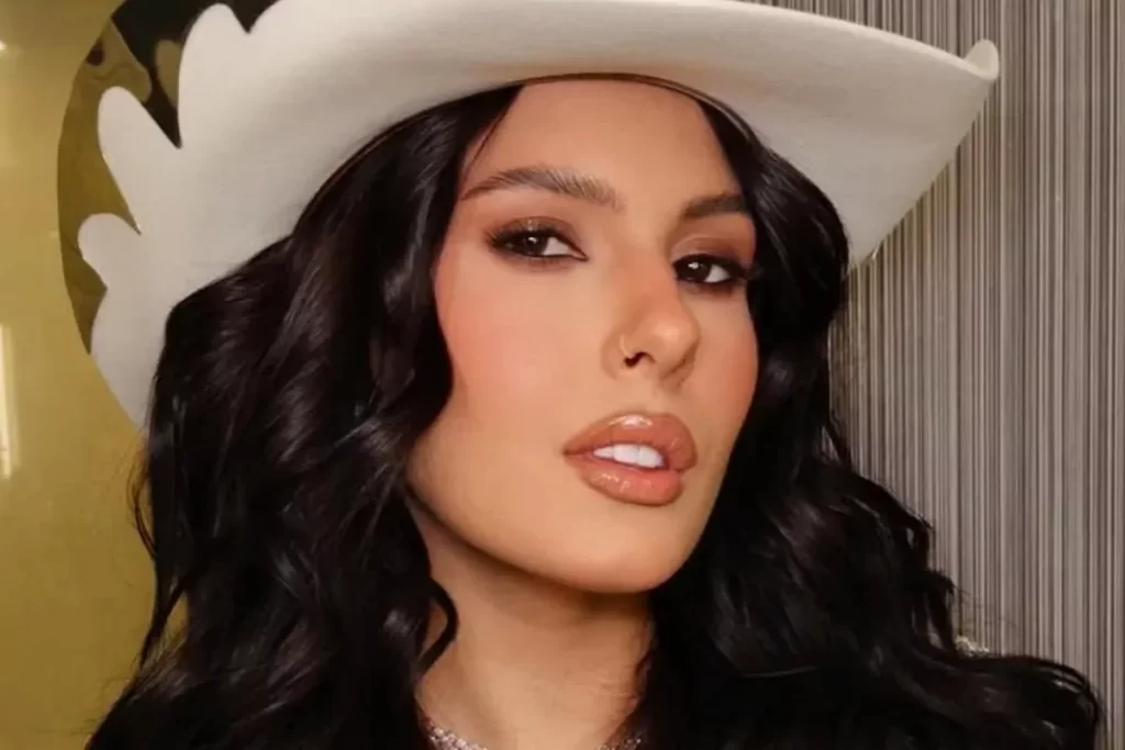 Ana Castela atualiza estado de conjuntivite: ‘Azar’ – OFuxico
